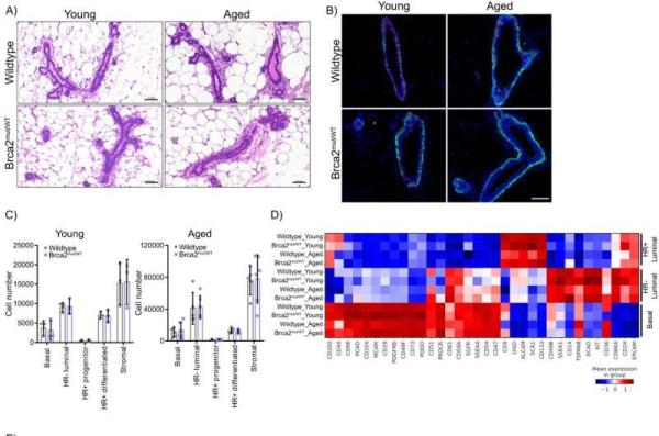 研究提供了BRCA2突变个体早期乳腺癌发展的见解 